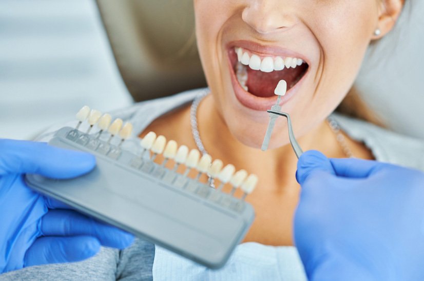 Key Elements of Dental Implants