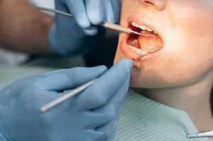 Root Canal Treatment Indirapurum