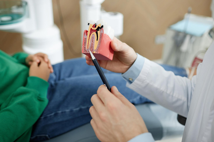 Root Canal vs Tooth Extraction