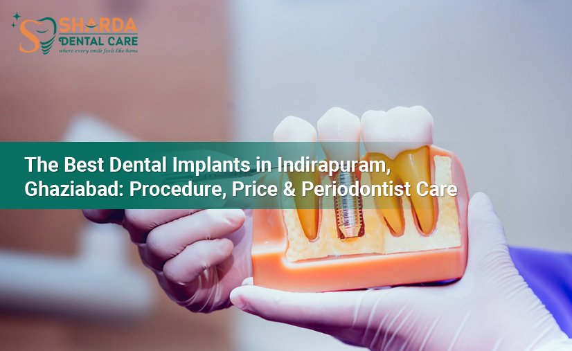 The Best Dental Implants in Indirapuram-Ghaziabad Procedure Price & Periodontist Care