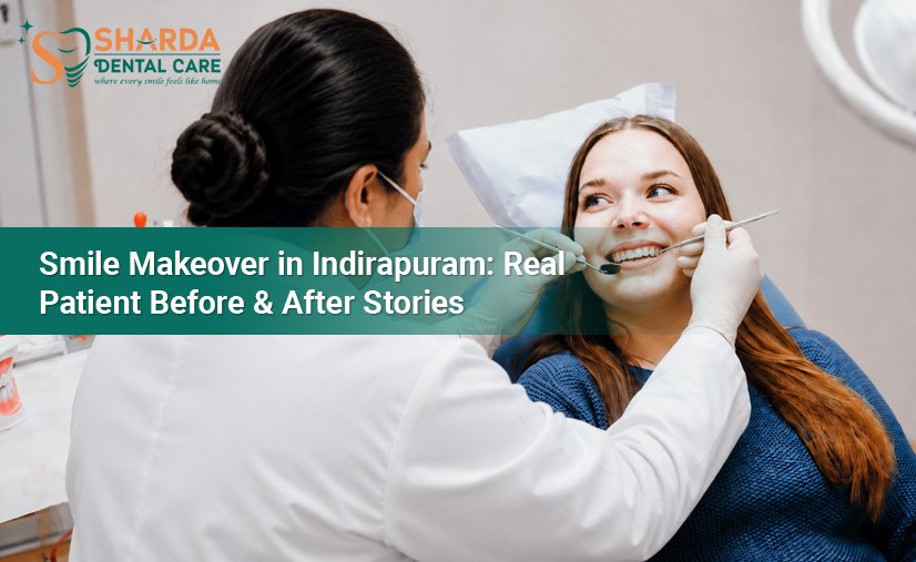 Smile-Makeover-in-Indirapuram-real-Patient-Before-&-After-Stories